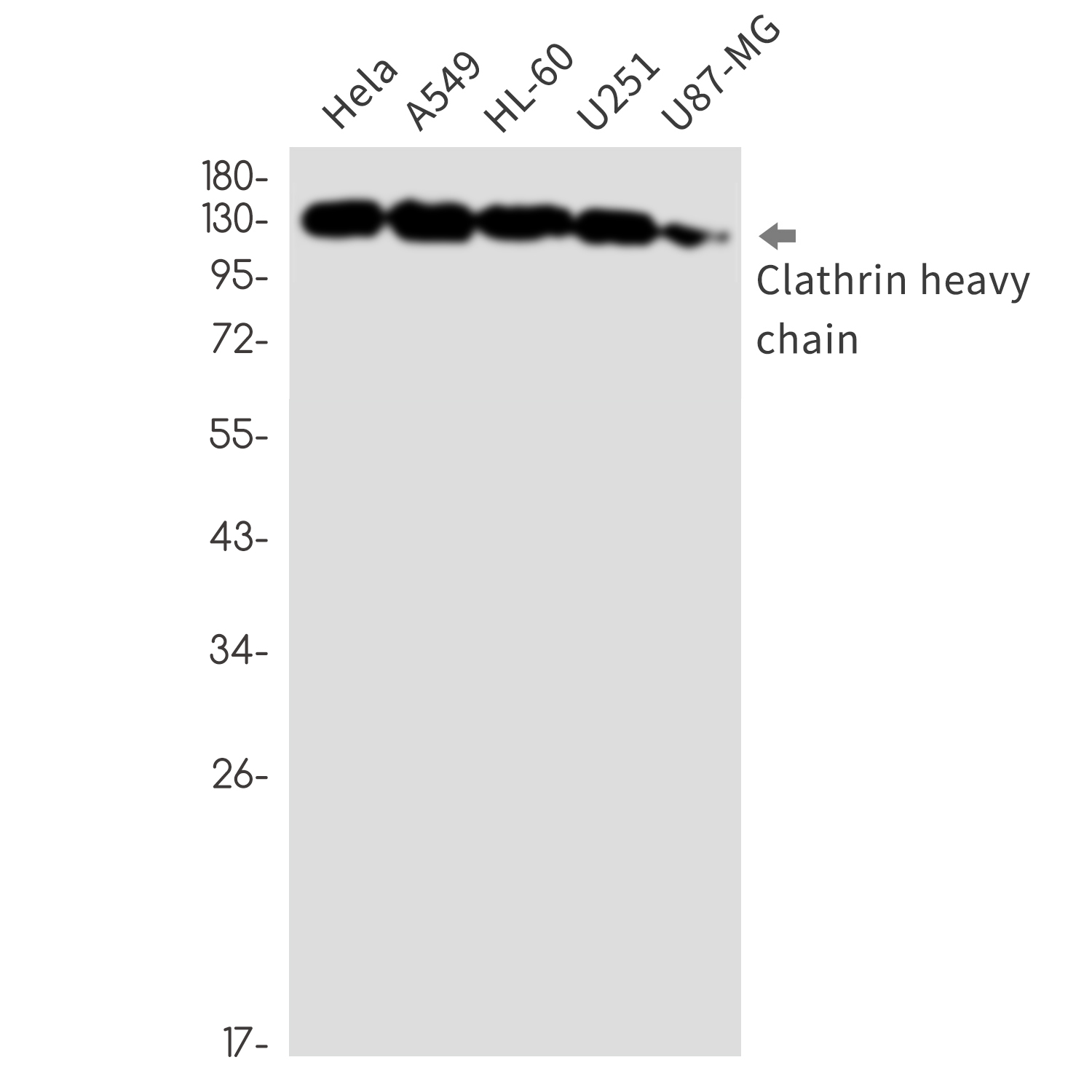 Clathrin Heavy Chain