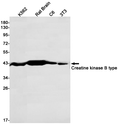 Creatine Kinase B type