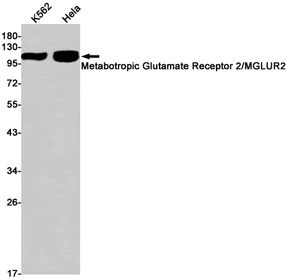 Metabotropic Glutamate Receptor 2