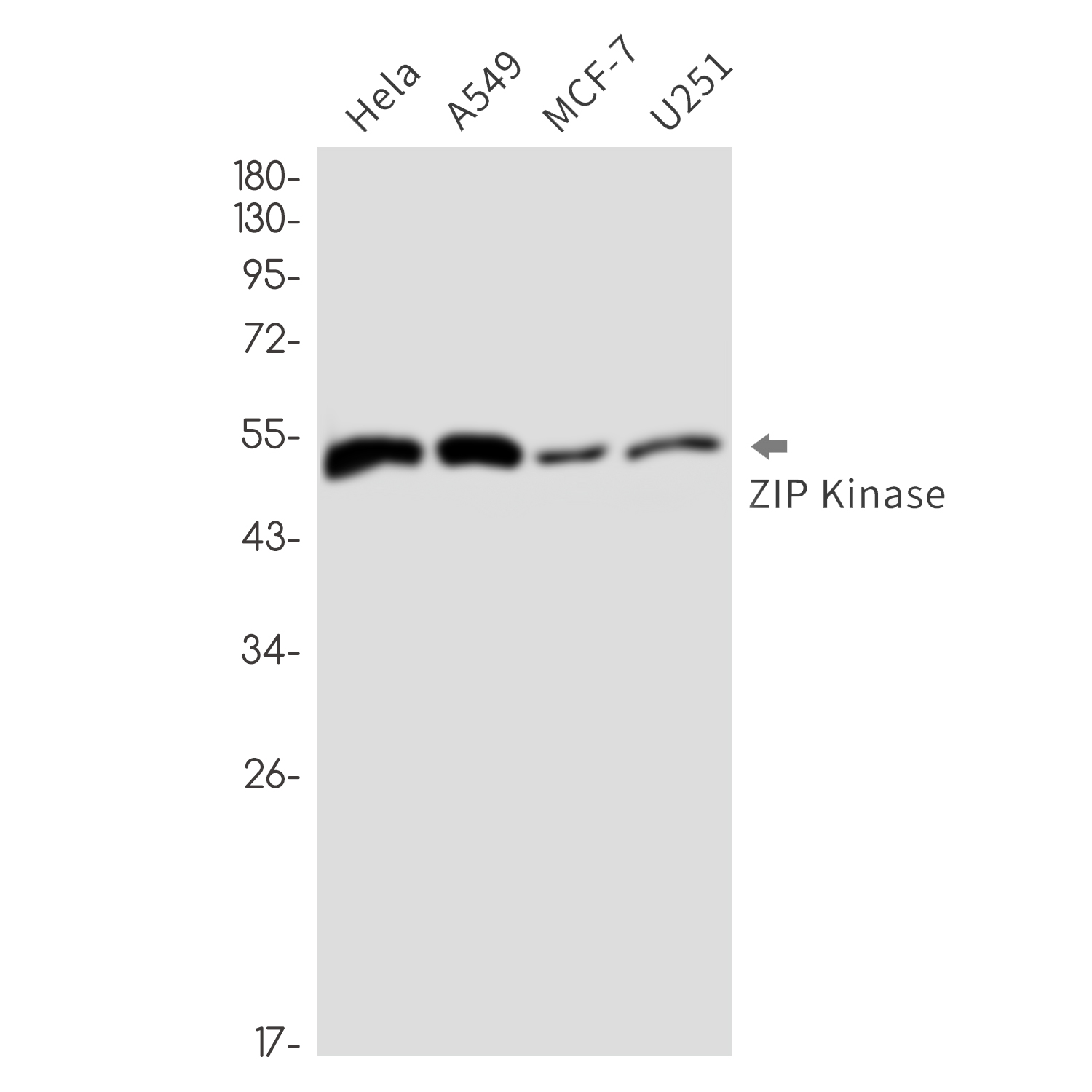 DAP kinase 3