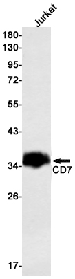 CD7