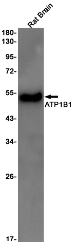 beta 1 Sodium Potassium ATPase