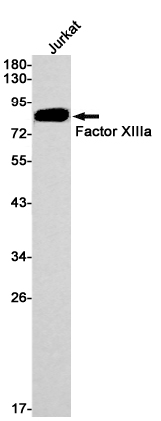 Factor XIIIa