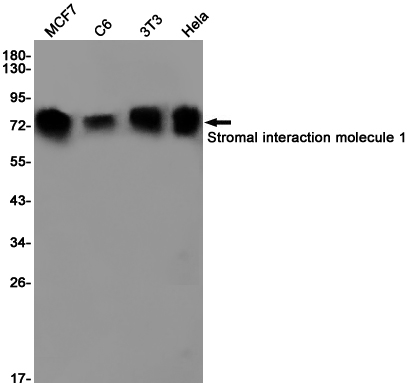 Stromal Interaction Molecule 1