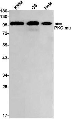 PKD1