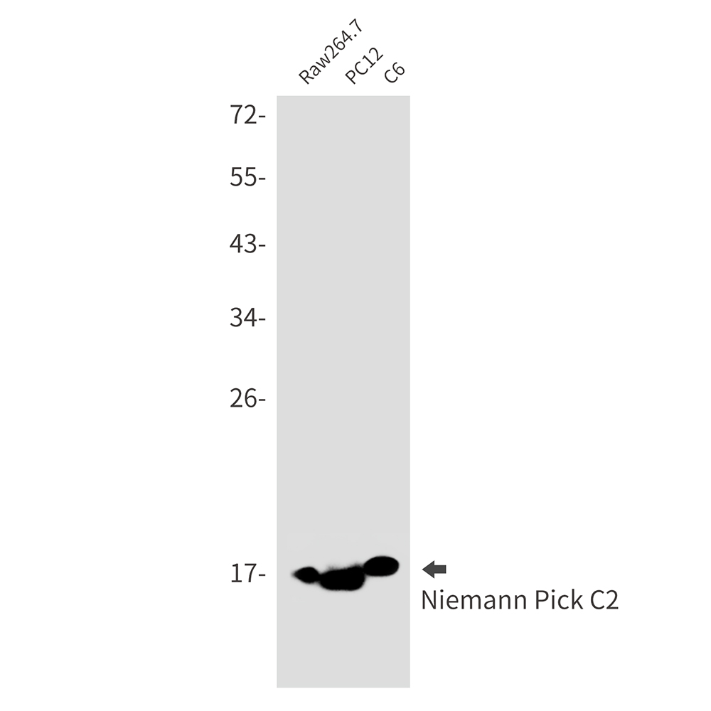 Niemann Pick C2