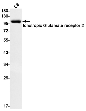 Ionotropic Glutamate Receptor 2
