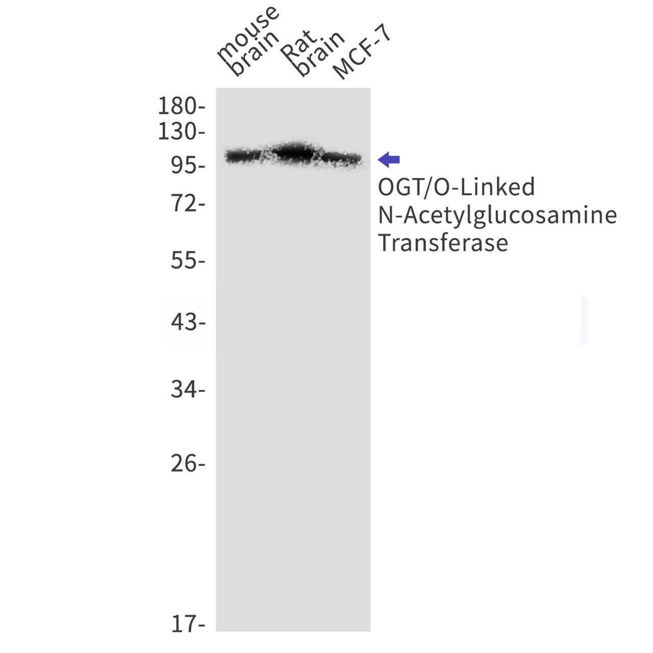OGT/O~Linked N~Acetylglucosamine Transferase