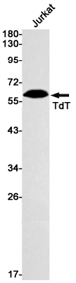 DNA Nucleotidylexotransferase