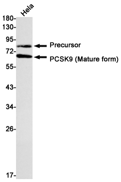 PCSK9