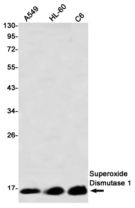 Superoxide Dismutase 1