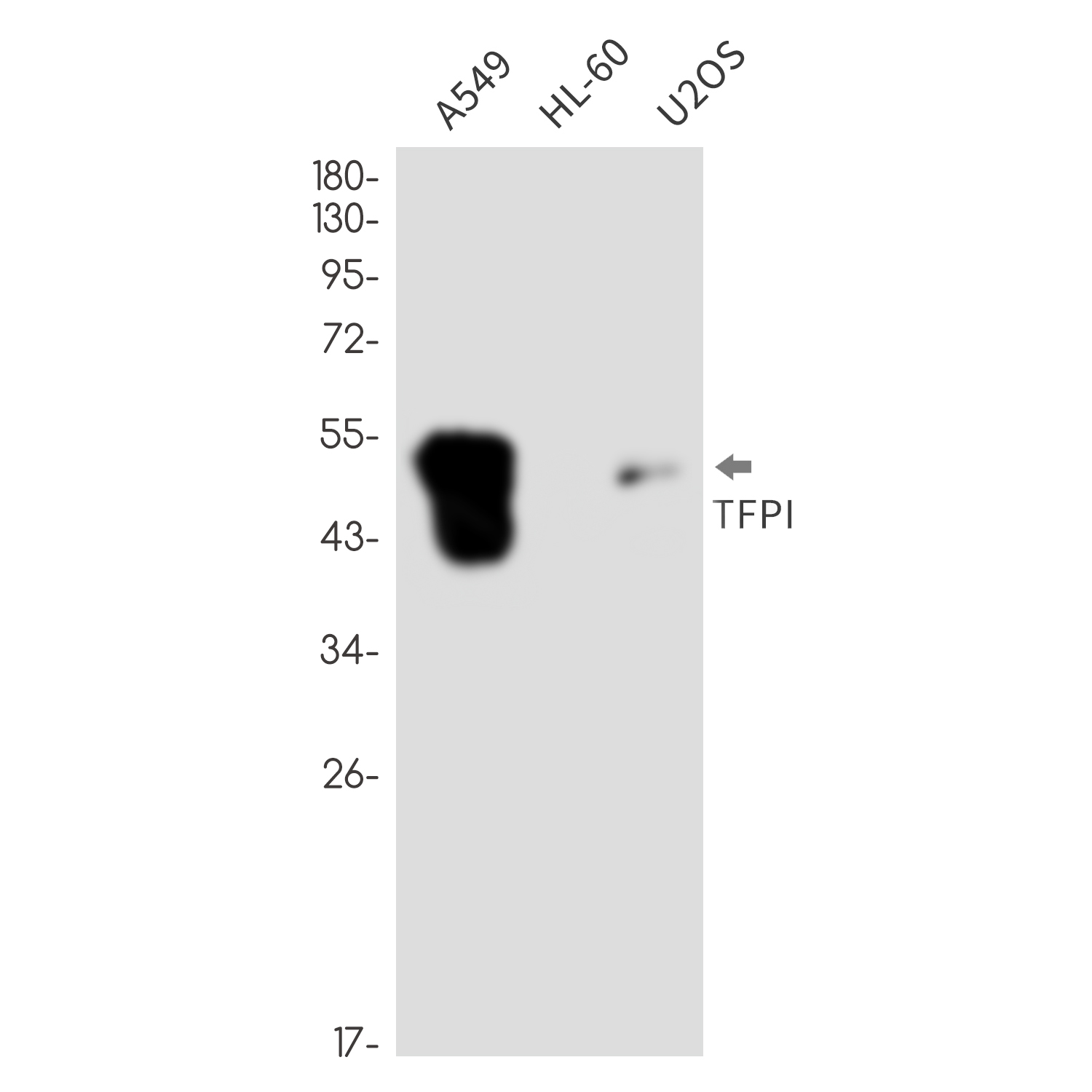 Tissue Factor Pathway Inhibitor