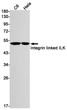 Integrin Linked ILK