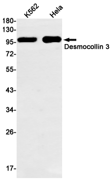 Desmocollin 3