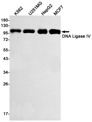 DNA Ligase IV