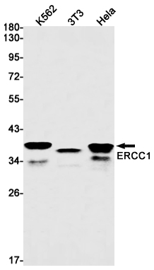 ERCC1
