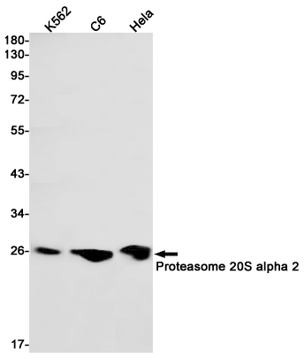 Proteasome 20S alpha 2