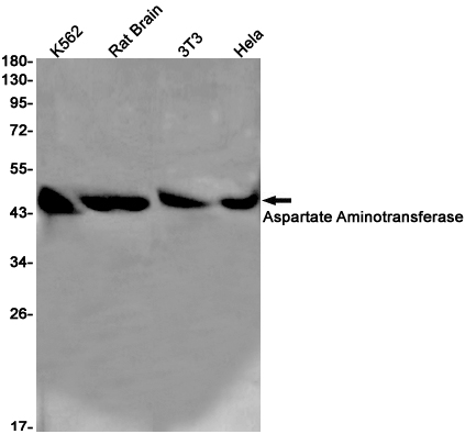 Aspartate Aminotransferase