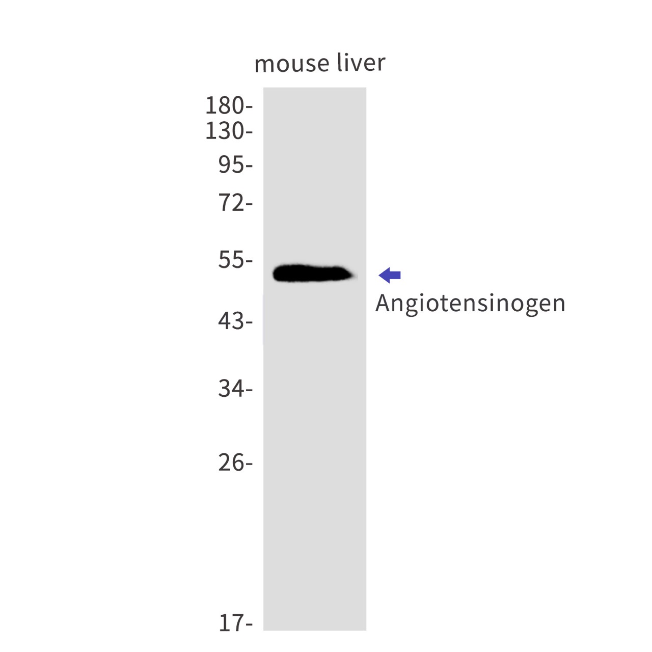Angiotensinogen