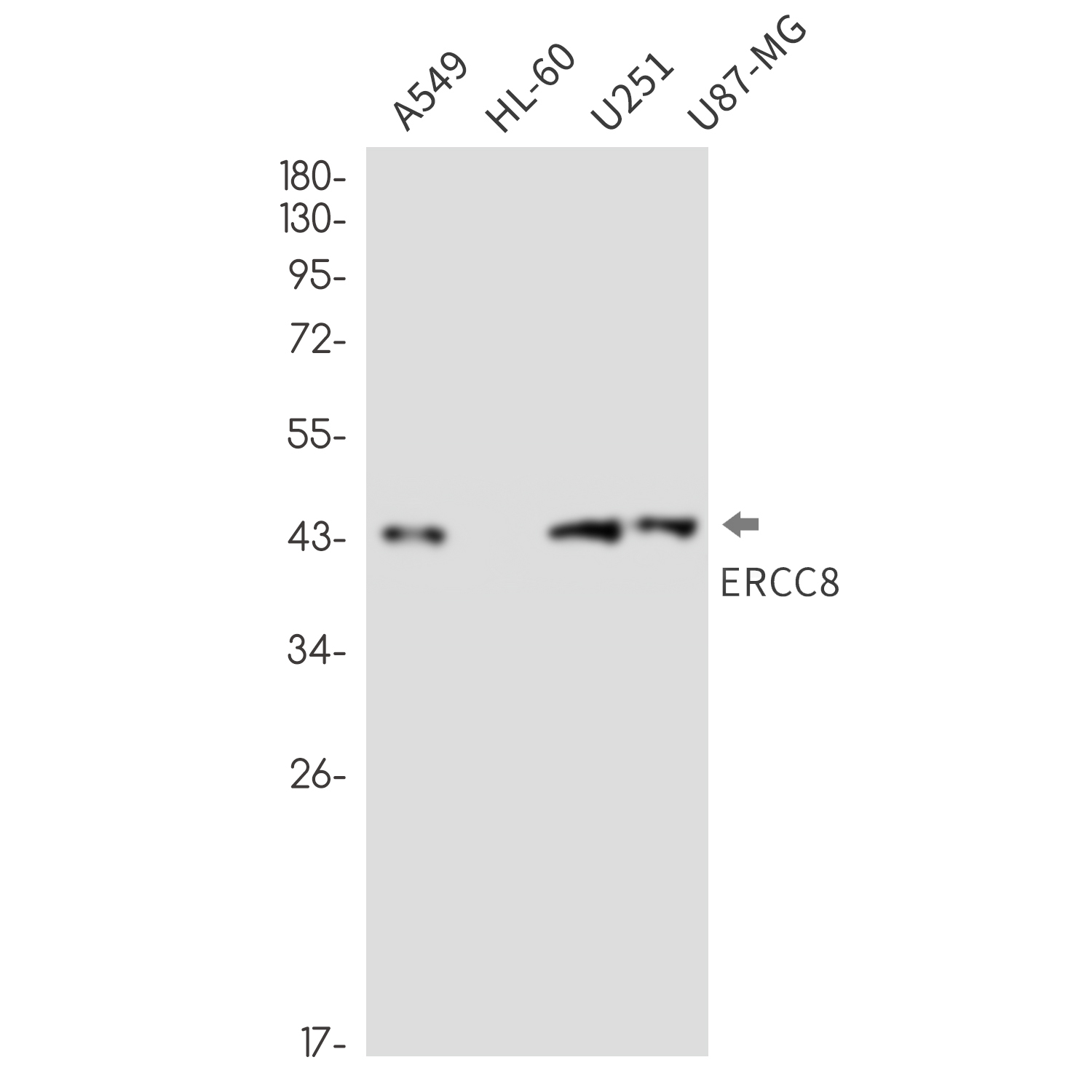 ERCC8