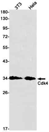 CDK4