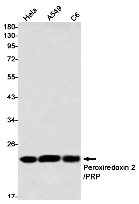 Peroxiredoxin 2