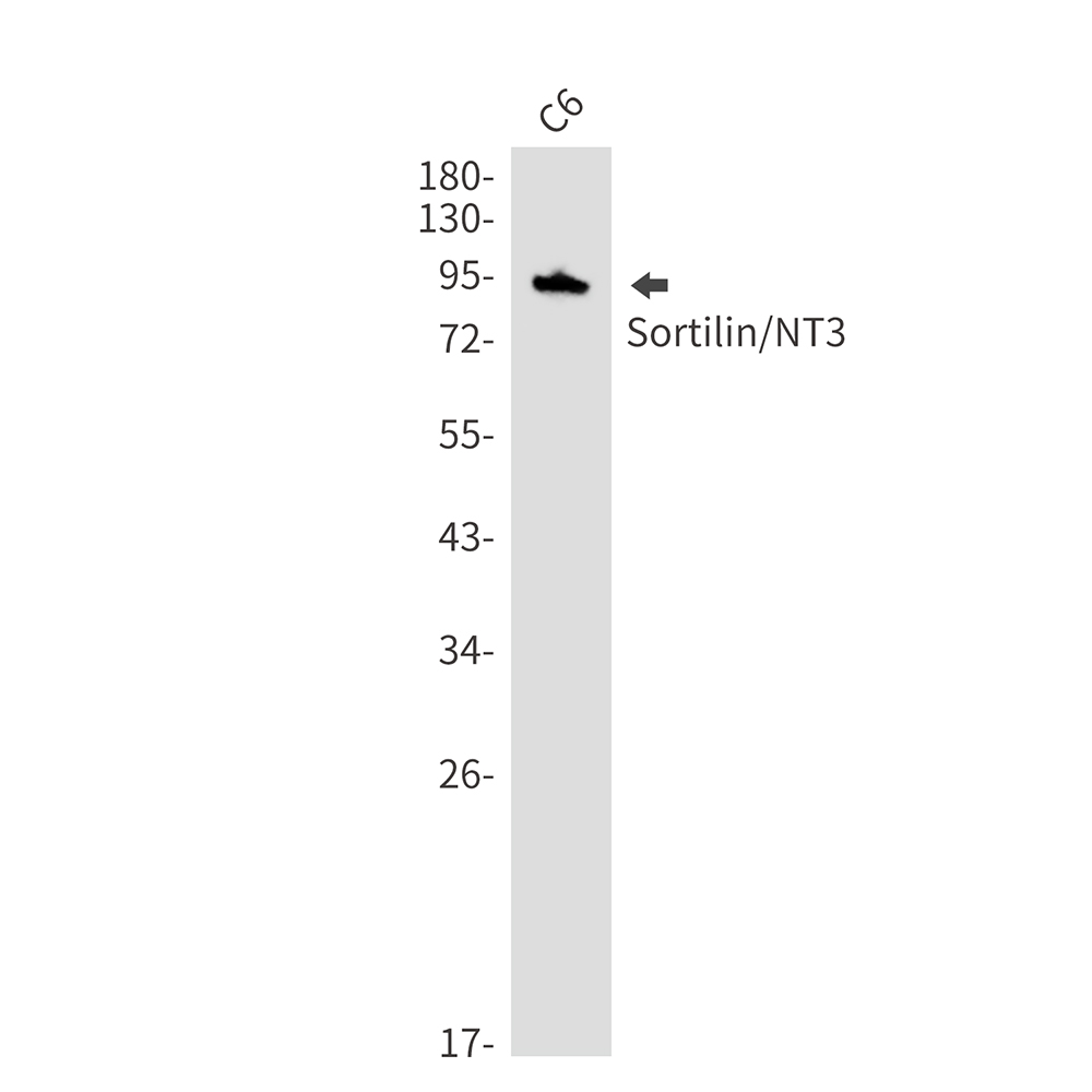 Sortilin