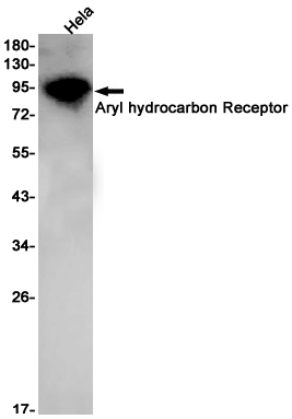 Aryl Hydrocarbon Receptor