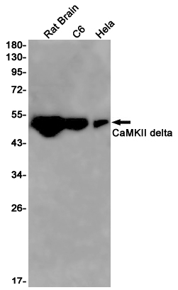 CaMKII delta