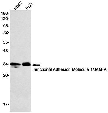 Junctional Adhesion Molecule 1