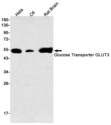 Glucose Transporter GLUT3