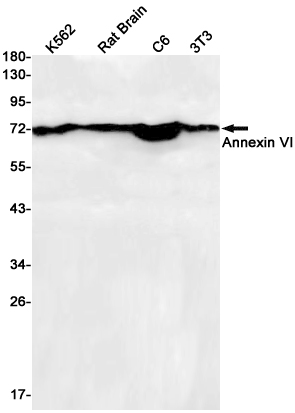 Annexin VI