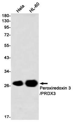 Peroxiredoxin 3