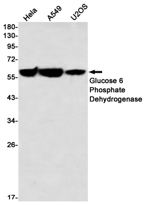 Glucose 6 Phosphate Dehydrogenase