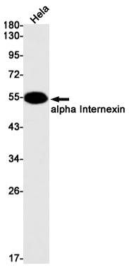 alpha Internexin