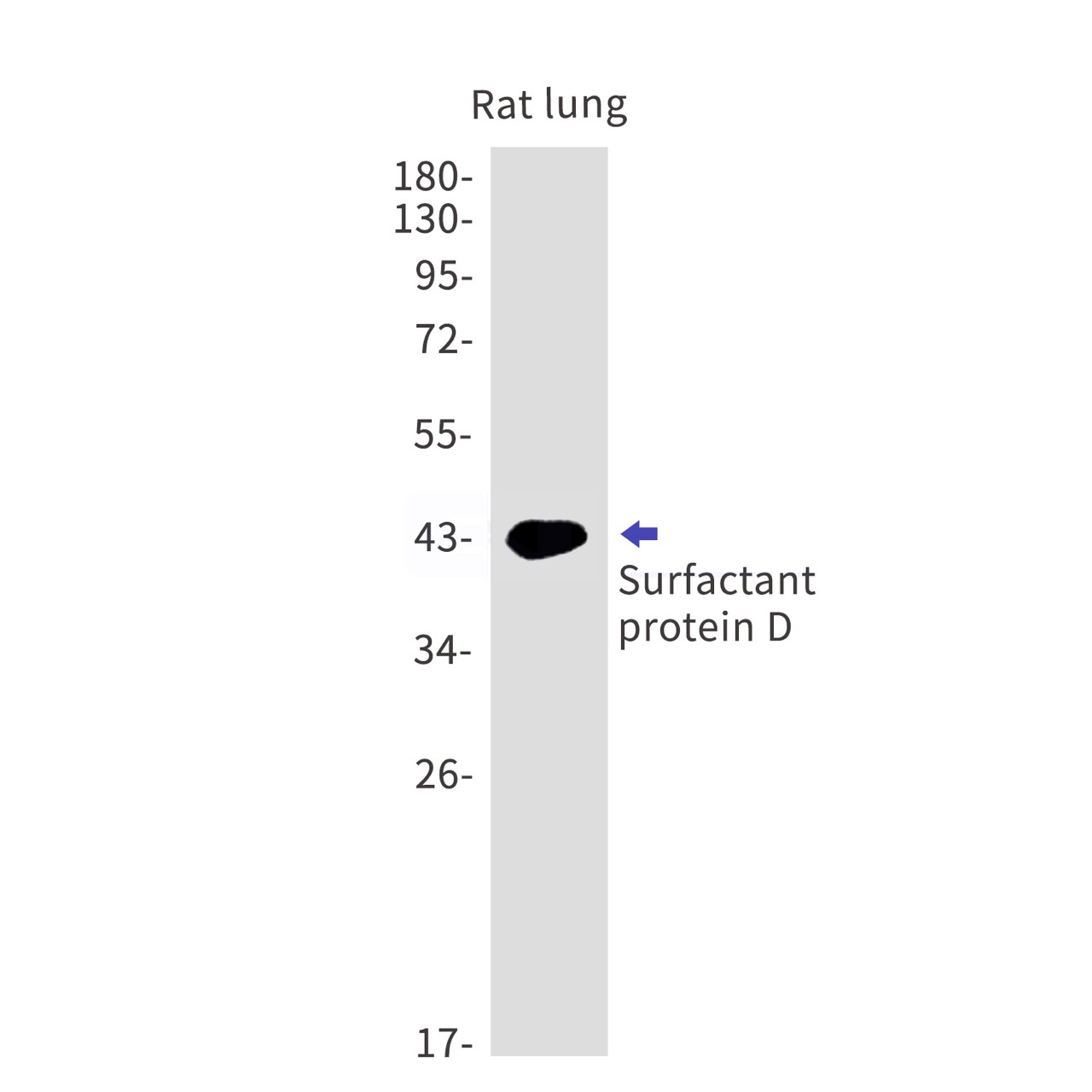 Surfactant protein D