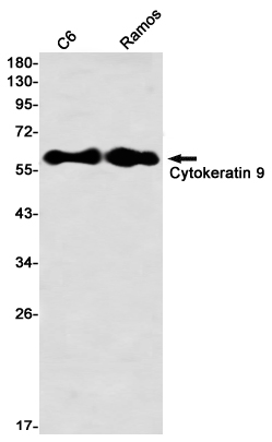 Cytokeratin 9