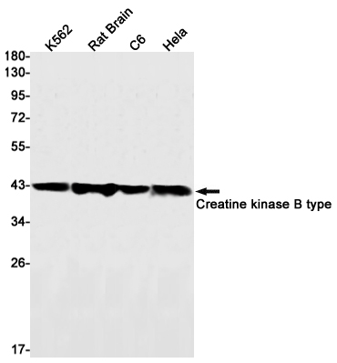 Creatine kinase B type