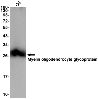 Myelin oligodendrocyte glycoprotein
