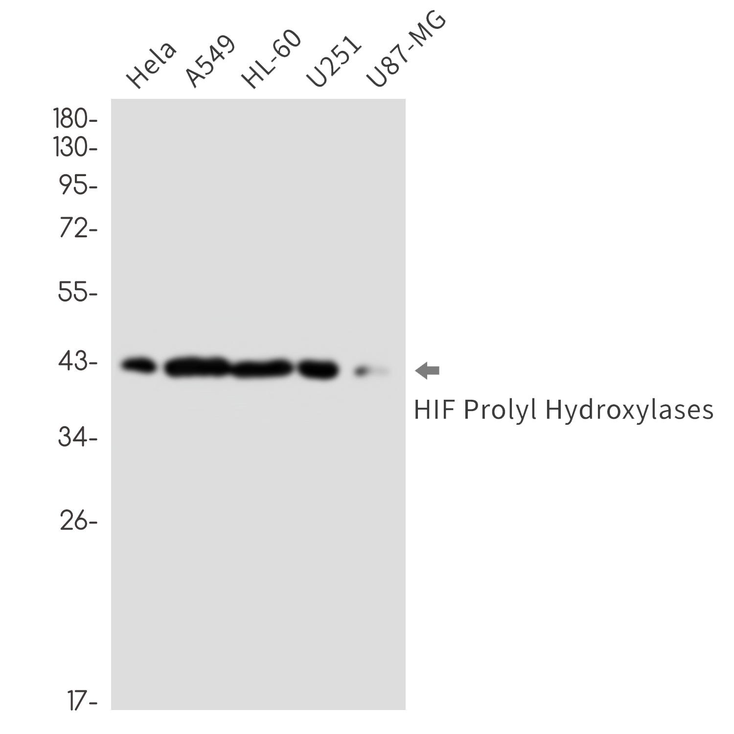 HIF Prolyl Hydroxylases