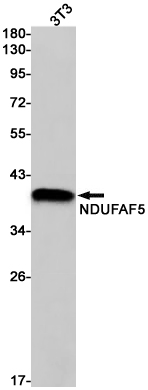 NDUFAF5
