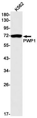 PWP1