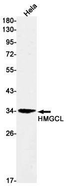 HMGCL