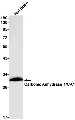 Carbonic Anhydrase I
