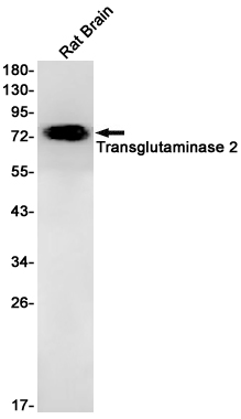 Transglutaminase 2