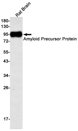 Amyloid Precursor Protein