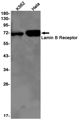 Lamin B Receptor
