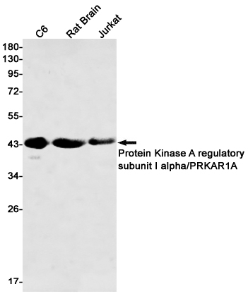 Protein Kinase A regulatory subunit I alpha