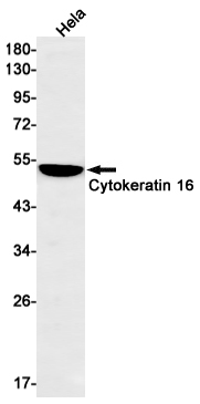Cytokeratin 16