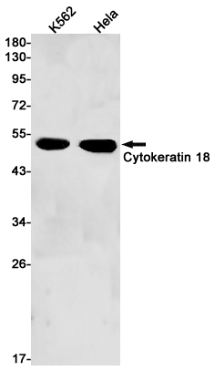 Cytokeratin 18
